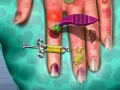 Игра Кожный доктор: Руки онлайн