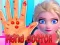 Игра Лечение руки у Эльзы онлайн